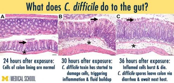 cdiff